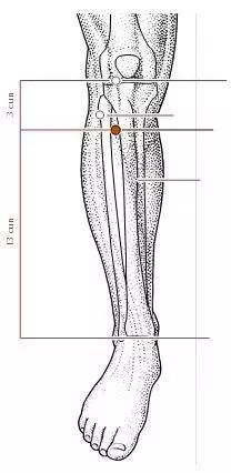 Fire Needle Therapy for Rheumatoid Arthritis