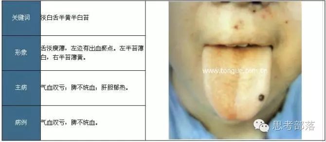 Comprehensive Guide to Tongue Diagnosis (8): 72 Types of Tongue Diagnosis Charts