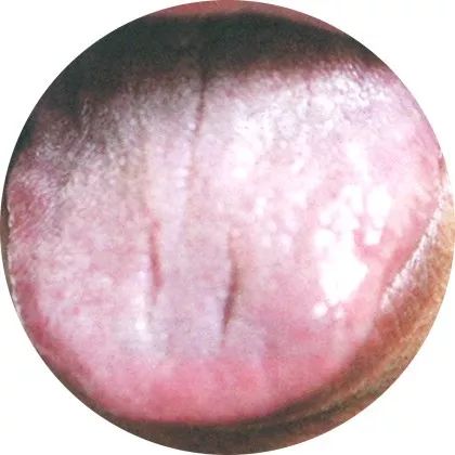 The Most Comprehensive High-Definition Real Tongue Diagnosis: Observing Tongue Patterns to Understand Internal Organs (Collection Edition)