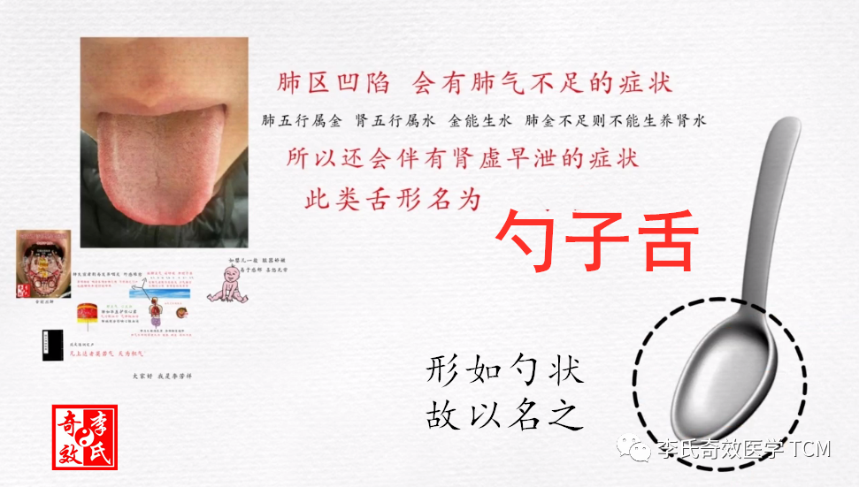 Tongue Diagnosis and the Lungs (Animated Version)