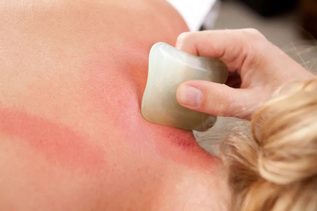 Gua Sha: A Gentle Scraping Technique to Regulate Qi and Blood, Boost Immunity!