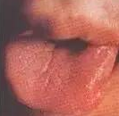 Comprehensive Guide to Tongue Diagnosis: Easily Understand Your Health Condition