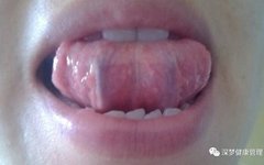 How to Regulate Blood Stasis Constitution to Prevent Illness?