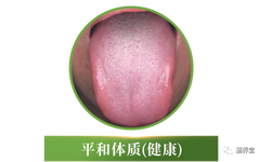 The Nine Constitutions in Traditional Chinese Medicine: Which One Are You?