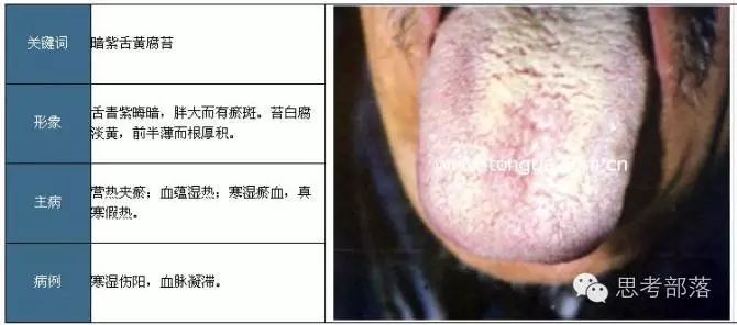 Comprehensive Guide to Tongue Diagnosis (8): 72 Types of Tongue Diagnosis Charts