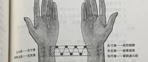 Understanding the Characteristics of Slippery Pulse in Traditional Chinese Medicine