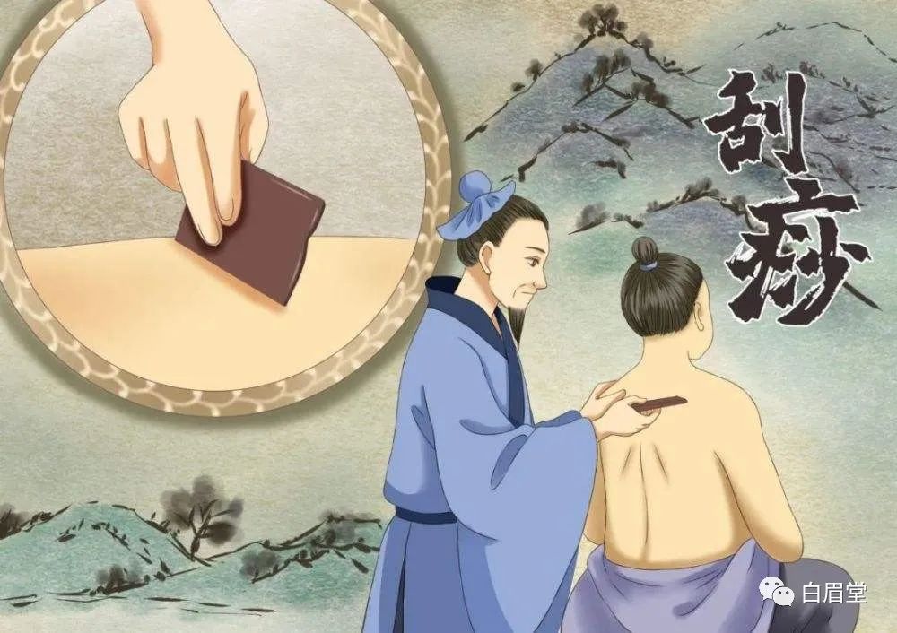 The Origins, Techniques, and Precautions of Gua Sha (Gua Sha: A Localized Method to Improve Circulation, Delay Aging, Promote Qi and Blood Flow, and Alleviate Pain)