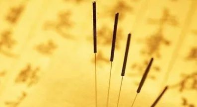 Acupuncture Specialty Treatment - Fire Needle