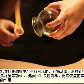 The Most Important Aspects of Cupping Therapy Revealed!
