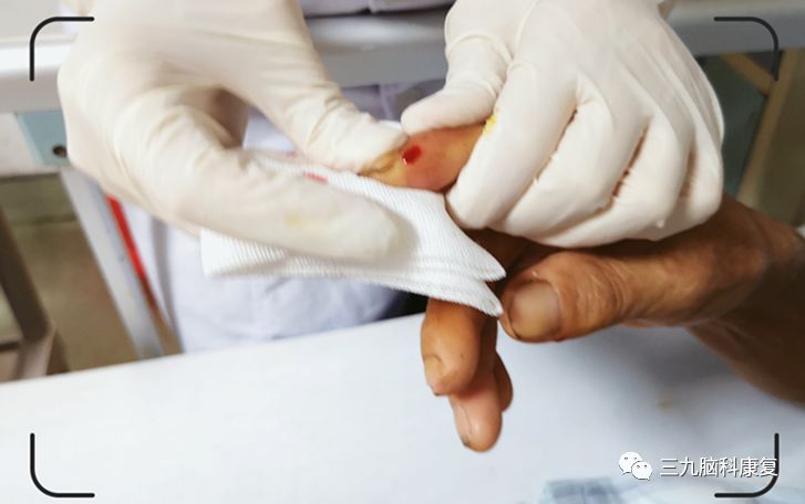 The Wonders of Bloodletting Therapy in Traditional Chinese Medicine