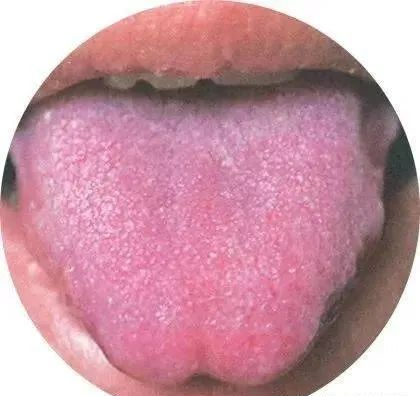 130 High-Definition Tongue Diagnosis Charts (Recommended for Collection)