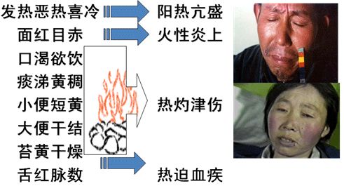 Essential Reading for Self-Study in TCM | Illustrated Eight Principles of Differentiation