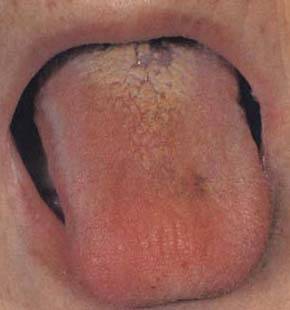 62 High-Definition Tongue Diagnosis Charts with Illustrations (Collector's Edition)