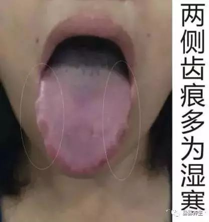 Tongue Diagnosis: A Clear Insight