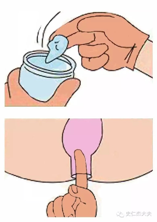 Rectal Examination in Traditional Chinese Medicine