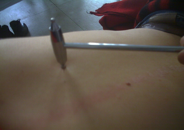 Dr. Li Discusses the 'New Nine Needles' and the Magnetic Round Plum Needle