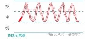 Analysis of the Slippery Pulse: Body Image, Main Diseases, and Associated Pulses