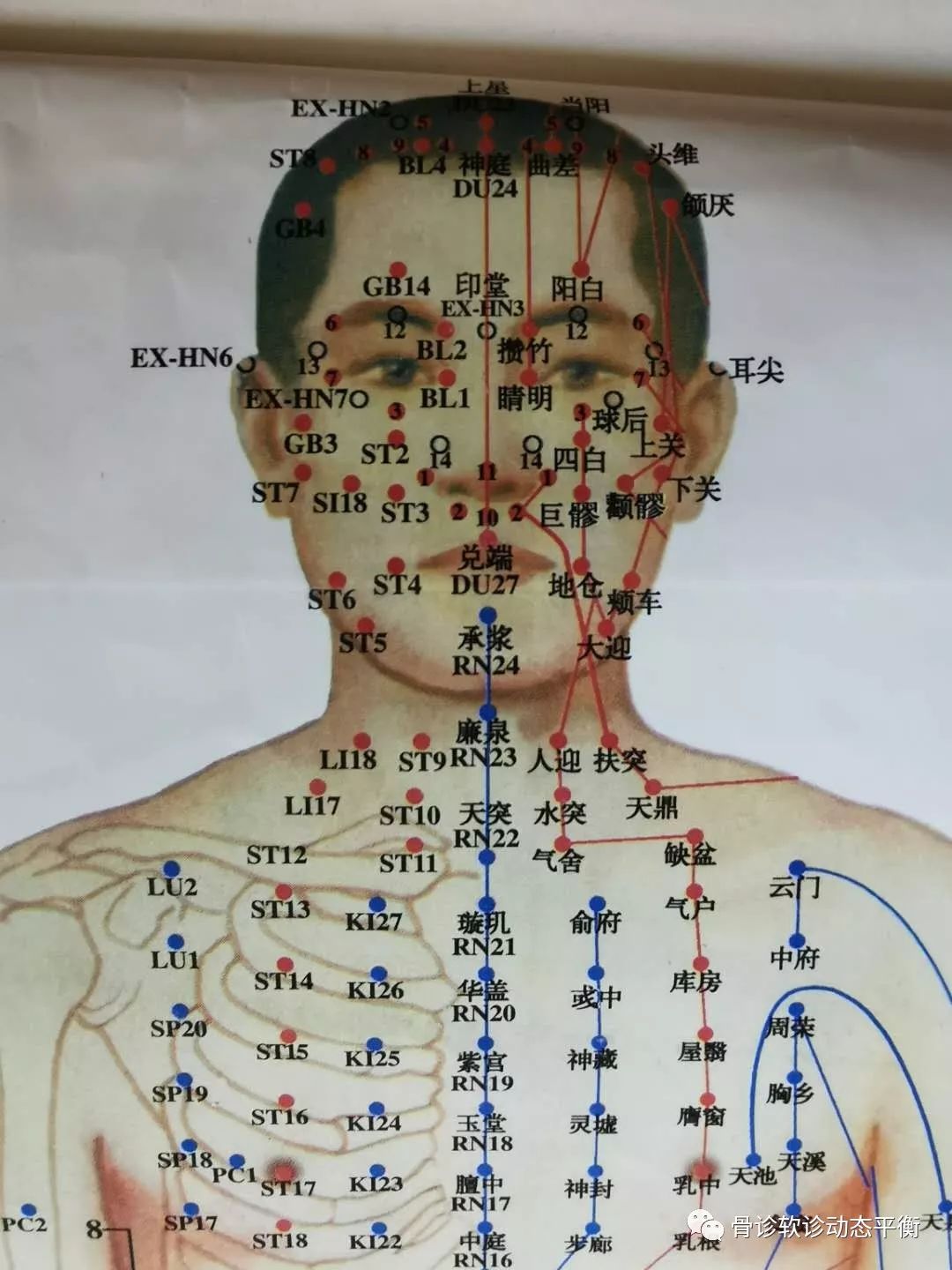 The Scope and Boundaries of the Efficacy of Fine Needling
