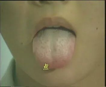 The Health Code Hidden on Your Tongue