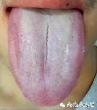 Foundations of Traditional Chinese Medicine: Phlegm-Dampness