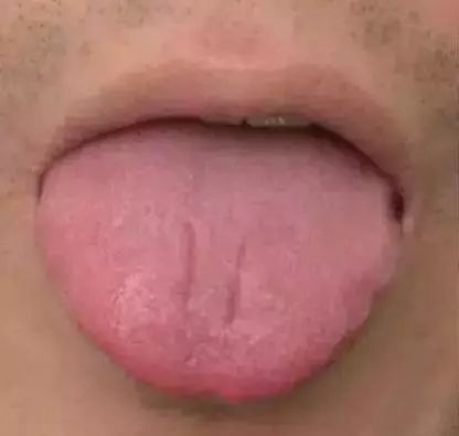 The Most Comprehensive Guide to Tongue Diagnosis! Master It and Become a Tongue Diagnosis Expert
