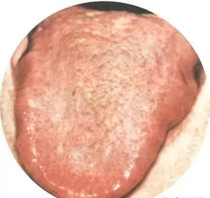 130 High-Definition Tongue Diagnosis Charts (Recommended for Collection)
