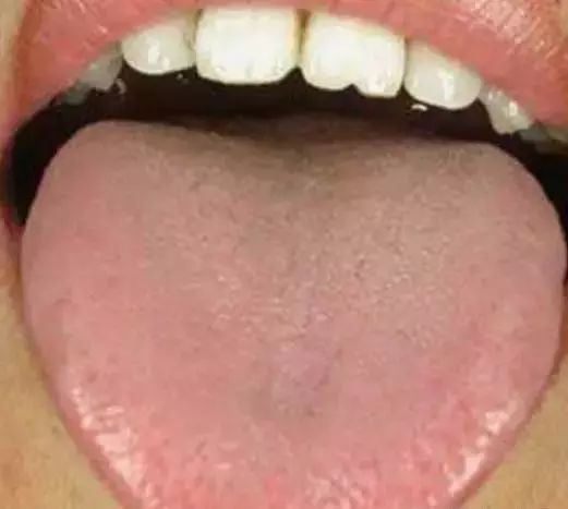 The Most Comprehensive Guide to Tongue Diagnosis! Master It and Become a Tongue Diagnosis Expert