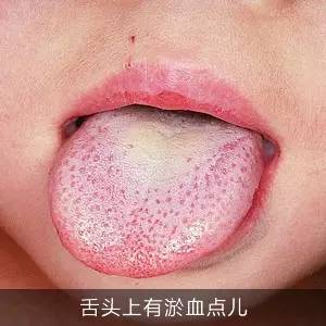 Symptoms and Dietary Remedies for Blood Deficiency, Blood Stasis, Blood Cold, and Blood Heat