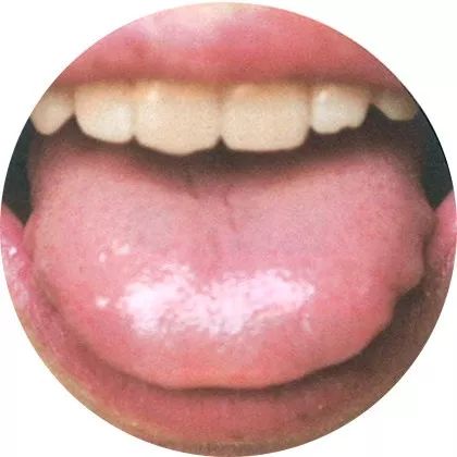 The Most Comprehensive High-Definition Real Tongue Diagnosis: Observing Tongue Patterns to Understand Internal Organs (Collection Edition)