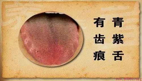 The TCM Tongue Diagnosis Atlas is Here! Observe the Tongue to Understand the Whole Body!