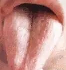 Comprehensive Guide to Tongue Diagnosis: Easily Understand Your Health Condition