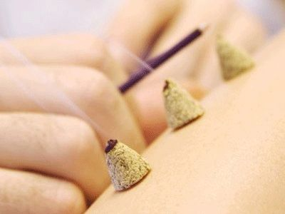 Spring Moxibustion: Awakening the Body and Revitalizing Energy