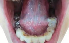 Exploring Tongue Diagnosis in Traditional Chinese Medicine: Hidden Insights and Tongue Diagnosis Atlas