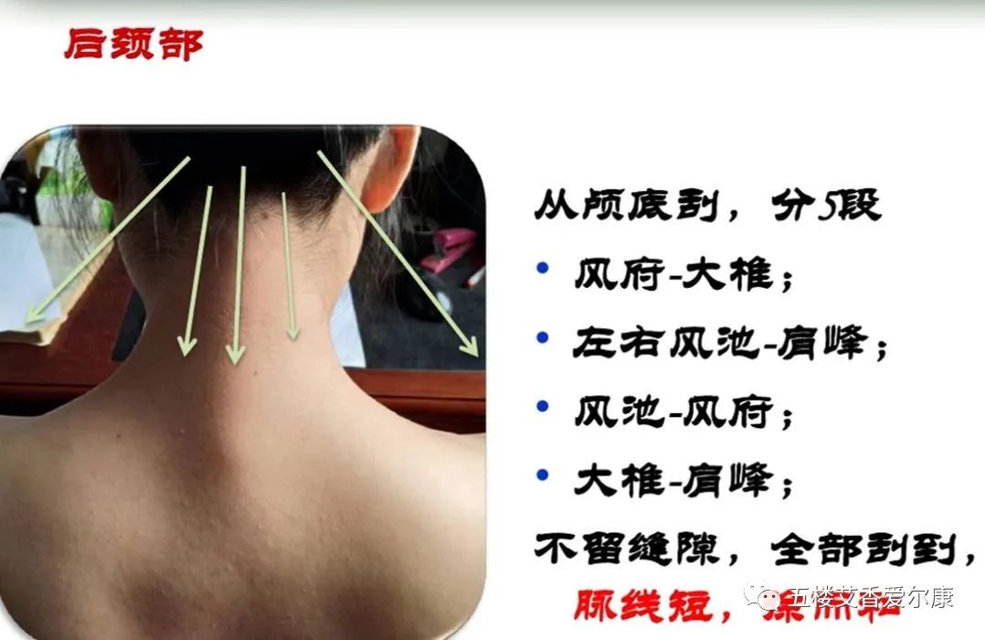 Summary of Common Diseases and Gua Sha Treatment Plans Including Human Reflex Maps, Contraindications, and Diagnosis of Sha Patterns