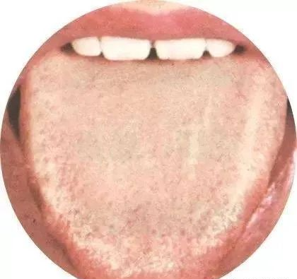 130 High-Definition Tongue Diagnosis Charts (Recommended for Collection)