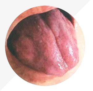 Analysis of High-Definition Tongue Diagnosis Charts: Understanding Health Through Your Tongue (Part 1)