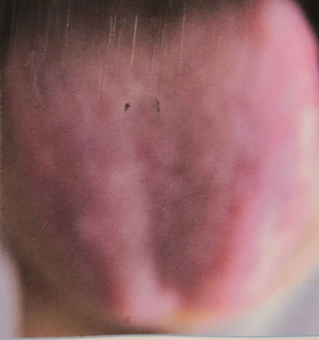 Inheritance of Traditional Chinese Medicine at Zhigu Tang | Basic Theory of TCM Lesson 34 (Tongue Diagnosis: Tongue Color)