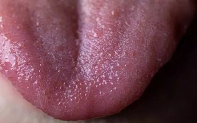Tongue Diagnosis in Traditional Chinese Medicine: Observing Tongue Color, Shape, State, and Coating