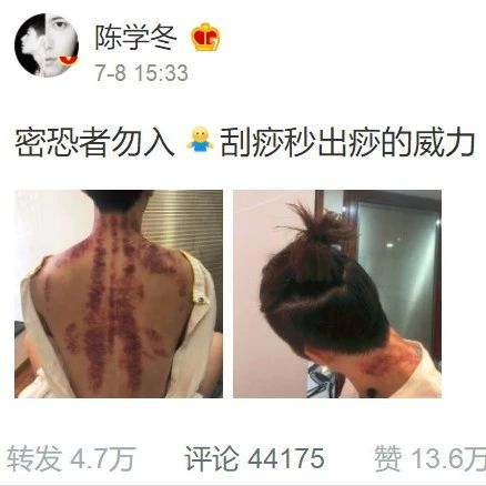 Chen Xuedong Shares His Gua Sha Experience: Experts Warn Against Incorrect Techniques That May Harm Kidney Function!