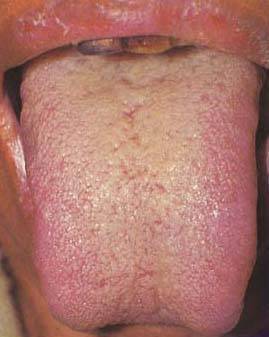 62 High-Definition Tongue Diagnosis Charts with Illustrations (Collector's Edition)