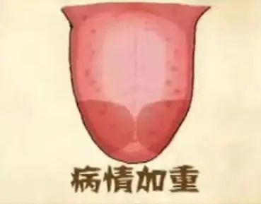Should You Scrape Yellow and Thick Tongue Coating? Find Out Here