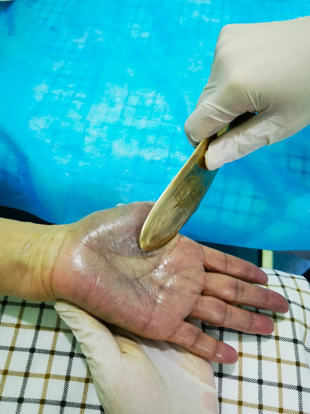 Understanding Hand Gua Sha in Traditional Chinese Medicine