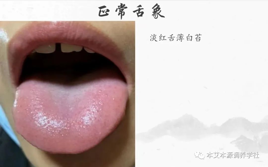 Tongue Diagnosis Series 3: Precise Differentiation of Tongue Coating, Quality, and Shape