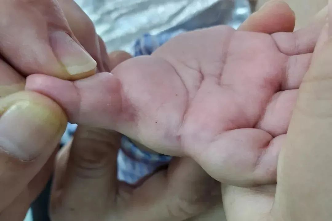 Observing Children's Fingerprints: The Secrets Hidden in Small Palms