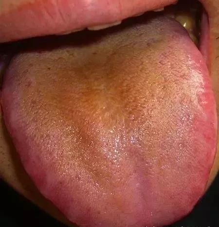 The TCM Tongue Diagnosis Atlas is Here! Observe the Tongue to Understand the Whole Body!
