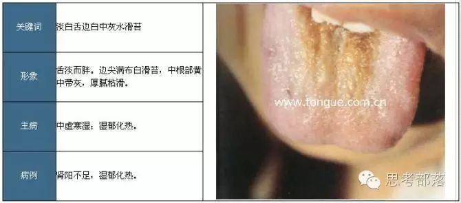Comprehensive Guide to Tongue Diagnosis (8): 72 Types of Tongue Diagnosis Charts