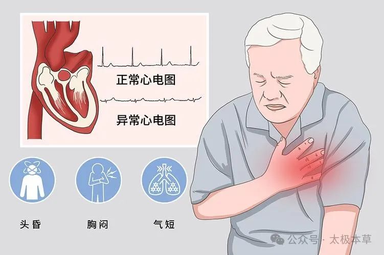 Experience of Traditional Chinese Medicine in Treating Bradycardia with Wen Yang Yi Qi Fu Mai Decoction