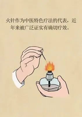 Understanding Fire Needle Therapy in Traditional Chinese Medicine