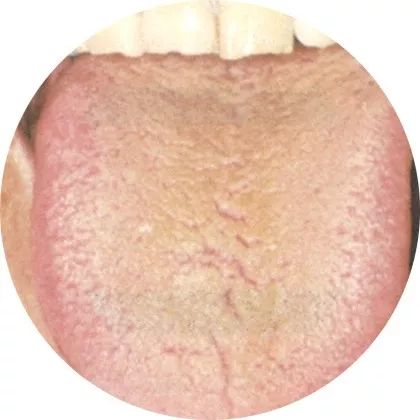 The Most Comprehensive High-Definition Real Tongue Diagnosis: Observing Tongue Patterns to Understand Internal Organs (Collection Edition)
