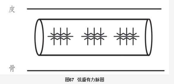 Understanding the Xian Pulse in Traditional Chinese Medicine